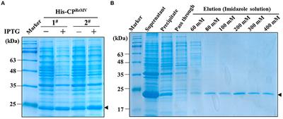 Development of polyclonal antibodies-based serological methods for detection of the rehmannia mosaic virus in field plants